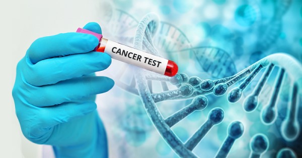 Xét nghiệm máu chẩn đoán ung thư có thể ứng dụng được không?