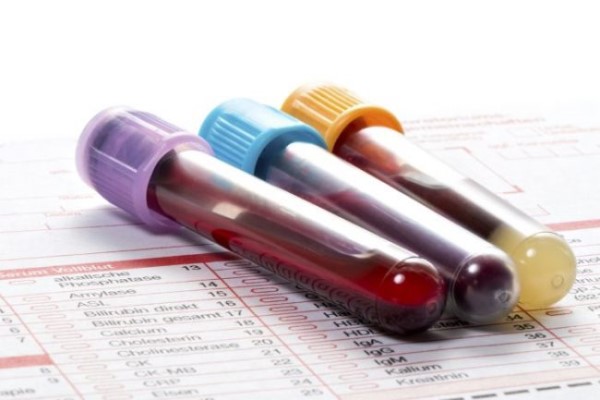 Xét nghiệm máu và các xét nghiệm thường gặp trong khám tổng quát